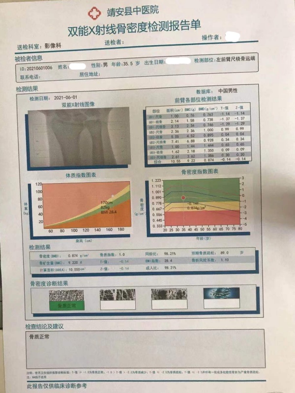 江西省靖安县中医院引进品源双能X射线骨密度仪